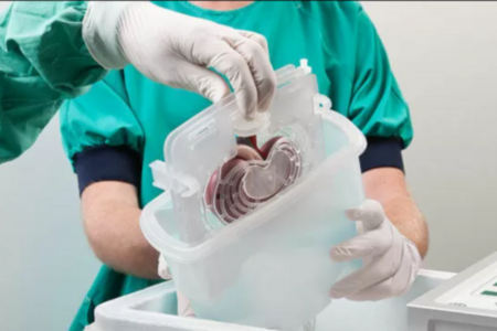 Azərbaycanda bu il neçə nəfərin orqan transplantasiyası etdiyi məlum olub