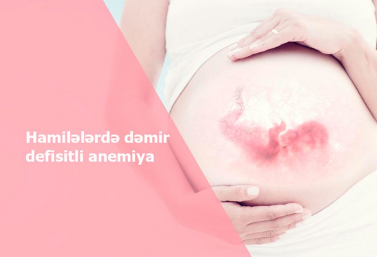 Hamiləlikdə Anemiya ürək qüsurları riskini artırır