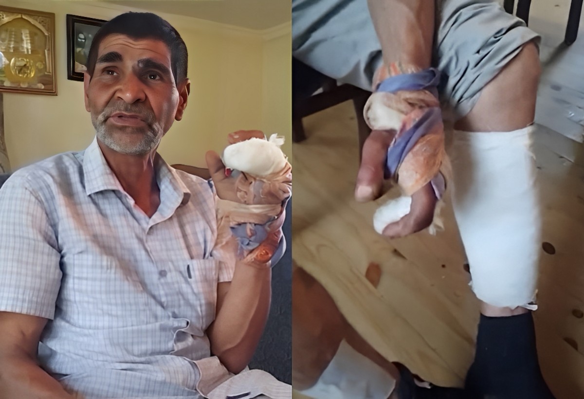 Sabirabadda çaqqal hücumu: Yaşlı kişi YARALANDI