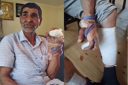 Sabirabadda çaqqal hücumu: Yaşlı kişi YARALANDI