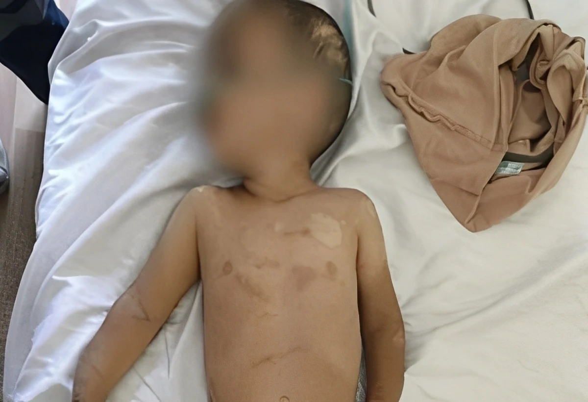 Ağdamda valideynləri tərəfindən döyülən digər azyaşlı da Bakıya gətirildi