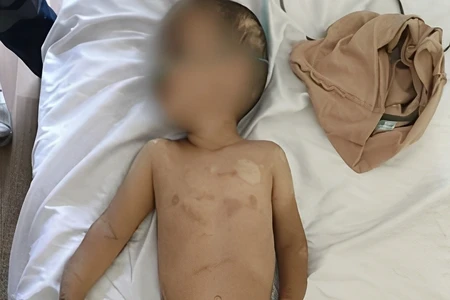 Ağdamda valideynləri tərəfindən döyülən digər azyaşlı da Bakıya gətirildi