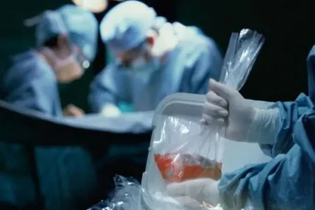 Meyit donordan orqan köçürülməsini gözləyənlərin sayı çoxalıb
