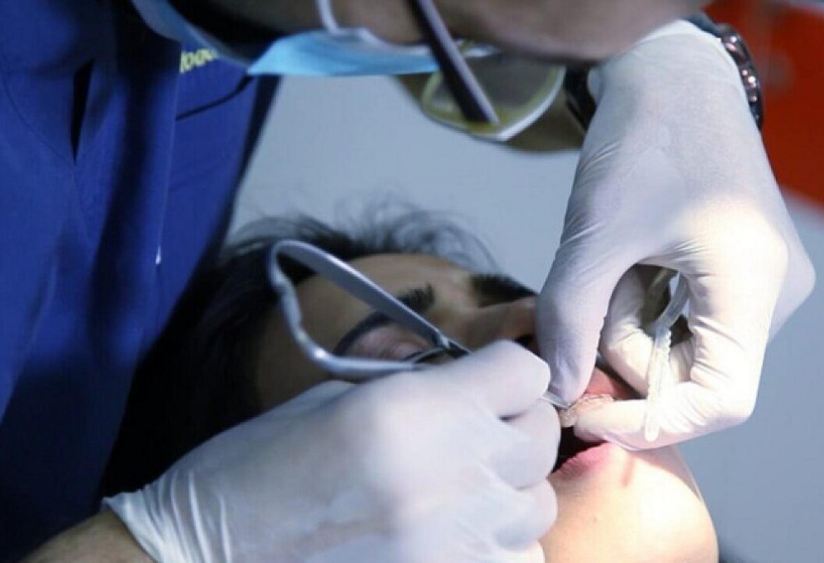 TƏBİB-dən stomatoloqlara XƏBƏRDARLIQ