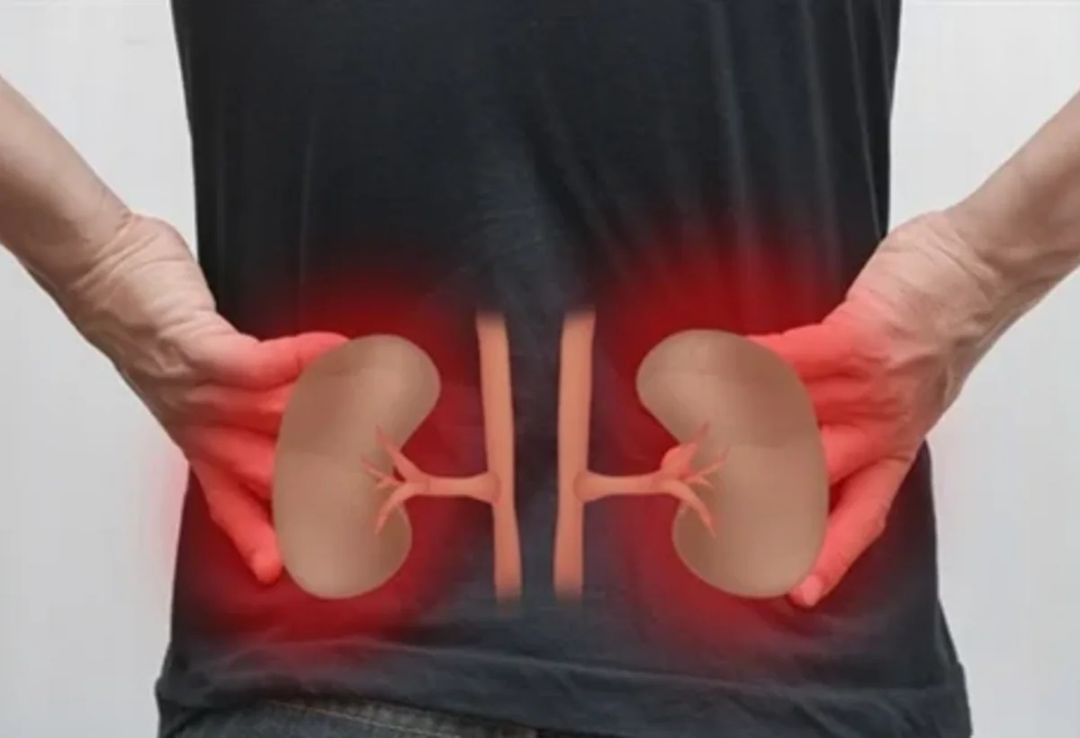 Azərbaycanda böyrək xəstəliyinin artmasına nə səbəb olur? - VİDEO