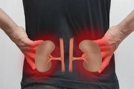 Azərbaycanda böyrək xəstəliyinin artmasına nə səbəb olur? - VİDEO