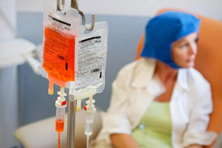 Alimlərdən kimyaterapiya ilə bağlı yaddaş zəifləməsinə qarşı sadə HƏLL YOLU