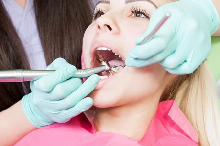 Diş daşlarının yaranma səbəbləri və mübarizə yolları – Mütəxəssis tövsiyələri