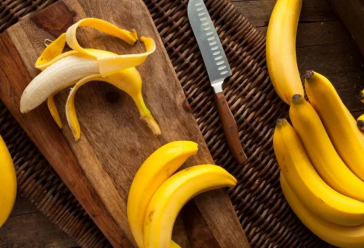 Bananın rəngi onun faydalılığını müəyyən edir – mütəxəssisin açıqlaması