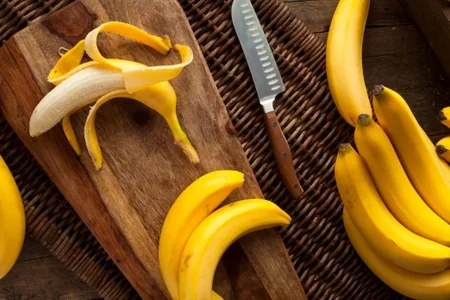 Bananın rəngi onun faydalılığını müəyyən edir – mütəxəssisin açıqlaması